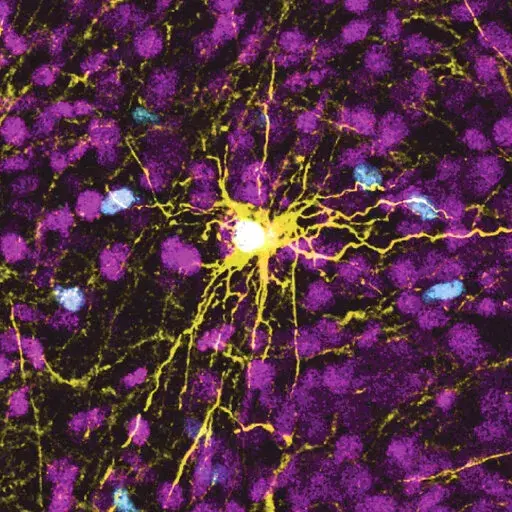 This microscope image provided by Pasca Lab/Stanford Medicine shows a human astrocyte cell, center in yellow, and human glial cells (scattered in blue) inside the brain of a rat. (Pasca Lab/Stanford Medicine via AP)