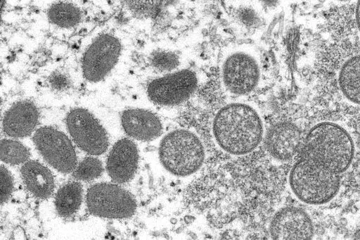 This 2003 electron microscope image made available by the Centers for Disease Control and Prevention shows mature, oval-shaped monkeypox virions, left, and spherical immature virions, right, obtained from a sample of human skin associated with the 2003 prairie dog outbreak. The Biden administration has started shipping testing kits for monkeypox to commercial laboratories, in a bid to speed diagnostic tests for suspected infections for the virus that has already infected at least 142 people in t