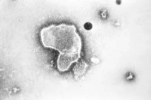This 1981 photo provided by the Centers for Disease Control and Prevention (CDC) shows an electron micrograph of Respiratory Syncytial Virus, also known as RSV.  New research announced by Pfizer on Tuesday, Nov. 1, 2022, showed vaccinating pregnant women helped protect their newborns from the common but scary respiratory virus that fills hospitals with wheezing babies each fall.  (CDC via AP, File)