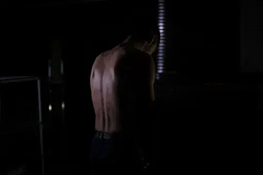 In this Nov. 23, 2022 photo, Igor shows the remains of marks on his back after allegedly being tortured by Russian forces in Kherson. The 22-year-old, accused of providing Ukrainians with Russia's military positions, was stung with a taser along his back for two and half hours and then forced to stay awake, seated in a chair all night. He was freed after two days but not before writing a letter providing details about a relative of his uncle's who the Russians wanted information on. (AP Photo/Be